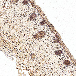 sars-cov-2 gene expression in a human fetus